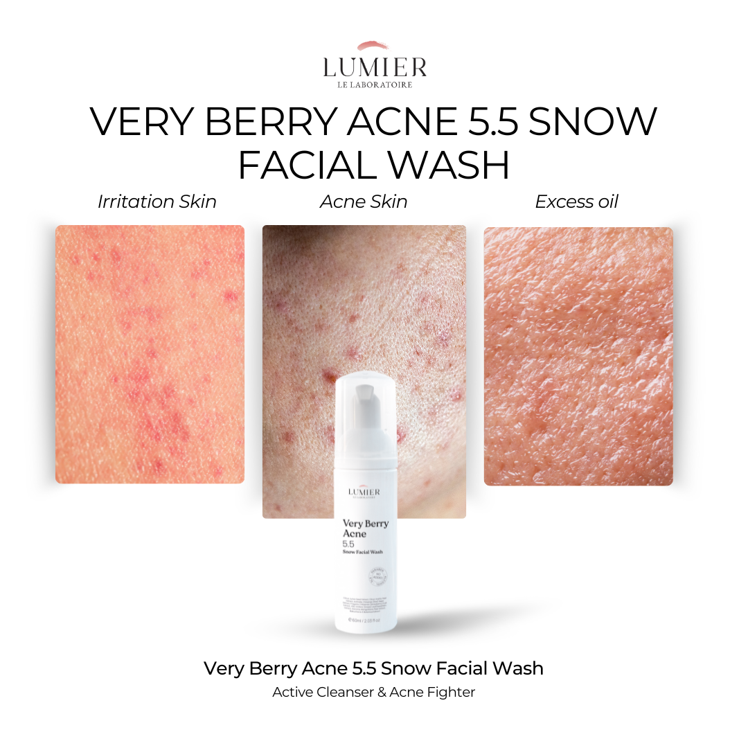 Very Berry Acne 5.5 Snow Facial Wash – 60ml