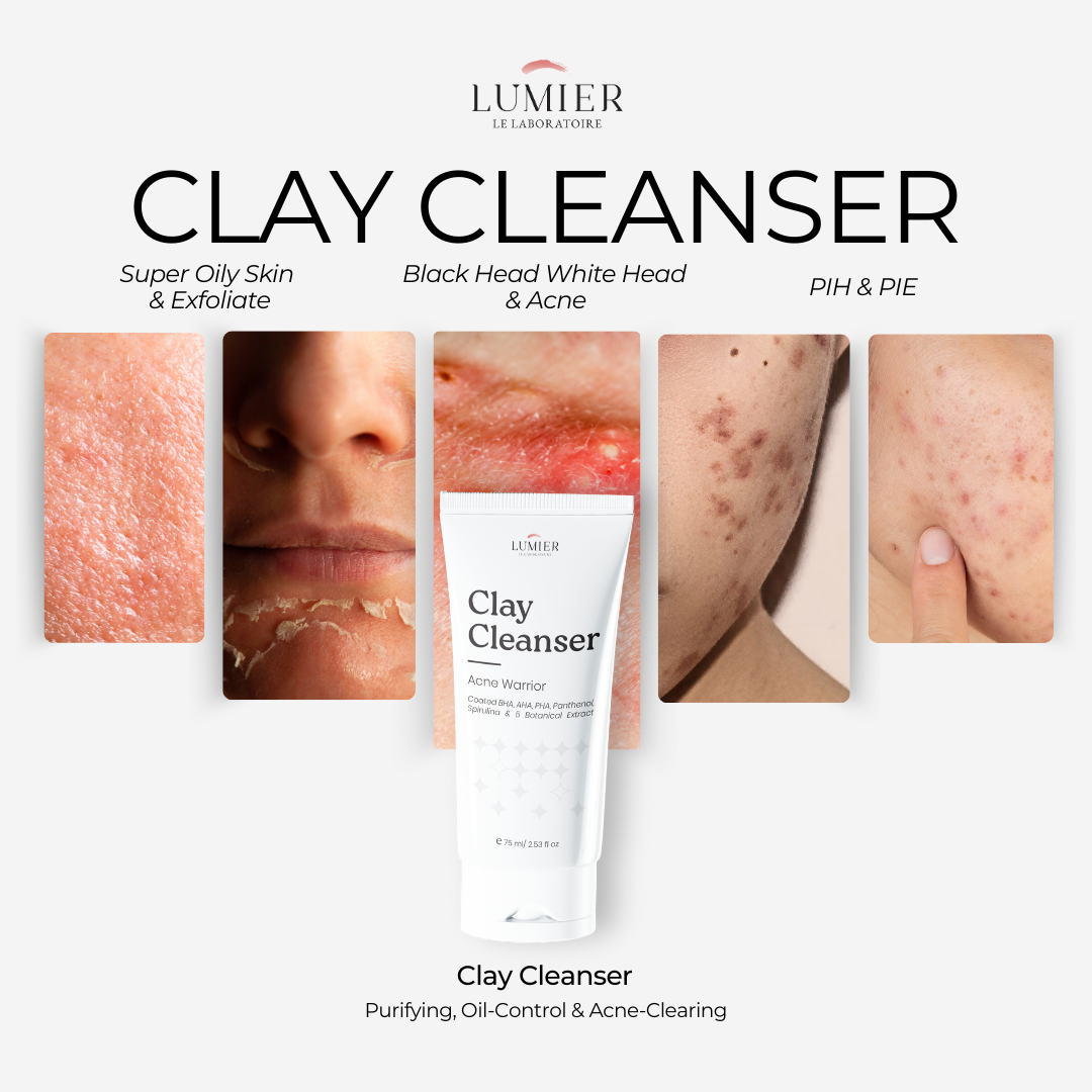 Clay Cleanser – Acne Warrior 