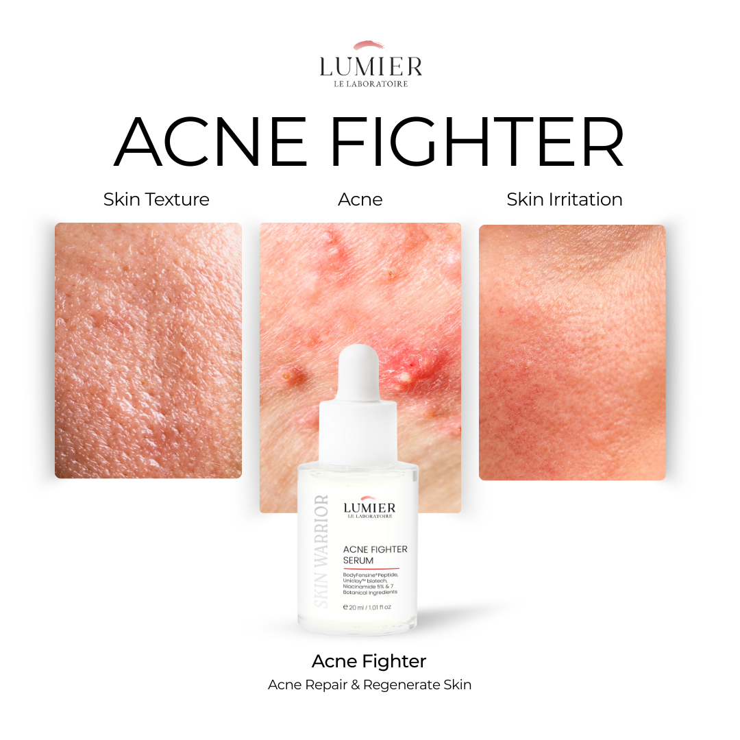 Skin Warrior Acne Fighter Serum – 20ml